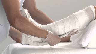 Plaster of Paris Lower Leg Splint Application [upl. by Rodriguez990]