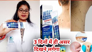 Wart Remover Ointment honest review 2023Wart Remover Ointment benefit usesampsideeffects review hindi [upl. by Arutak730]