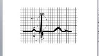 Basic Cardiology Cardiac Cycle Action Potential and the QRS Complex [upl. by Edina982]