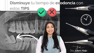 DISMINUYE TU TIEMPO DE EXODONCIA CON ESTOS TIPS [upl. by Nogas]