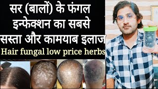 Hair fungal infection best low price herbal treatmentHair loss herbal treatment [upl. by Catlee420]