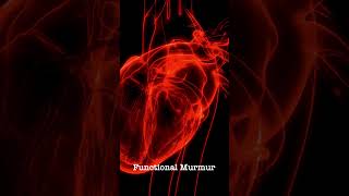 Normal Heart Sound vs Functional Murmur  Auscultation [upl. by Noremak]