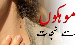 How to Rid Skin Tags and Warts  Remove Skin Tags Quickly  Urdu Hindi [upl. by Terrej757]