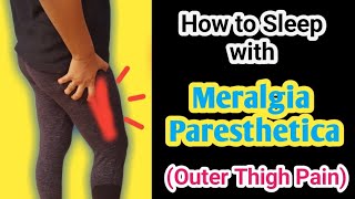 Tips to get relief from Meralgia Paresthetica  Selfcare tips  Outer thigh pain [upl. by Allerim]