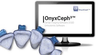 OnyxCeph³™ Overview 3D  2017 [upl. by Ayotl]