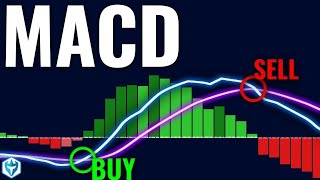 How I Nailed Trading with the MACD Indicator StepbyStep Guide [upl. by Kera885]