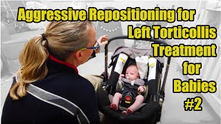 2L Aggressive Repositioning Left Torticollis Treatment Torticollis Treatment in Babies [upl. by Alak203]