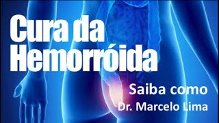 HEMORROIDA  CONHEÇA O TRATAMENTO Dr Marcelo Lima [upl. by Ahseikram]