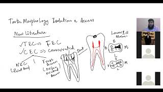 Tooth morphology isolation and access 1 [upl. by Elleivad269]