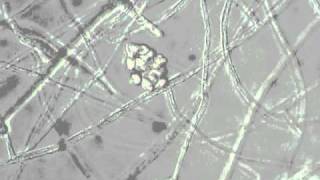 Pythium zoospore discharge [upl. by Sorilda]