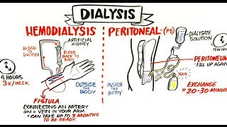 Failing Kidneys and Different Treatment Options [upl. by Saxen]