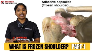 What is frozen shoulder   painful shoulder  shoulder stiffness [upl. by Arte117]