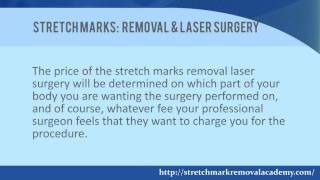 Laser Stretch Marks Removal Treatment In Hyderabad  Best Treatment For Stretch Marks  Hyderabad [upl. by Alegnaoj]