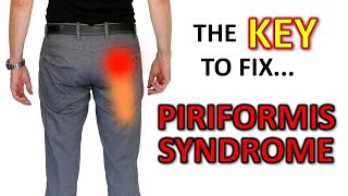 The KEY To Fix Piriformis Syndrome … For Good DON’T stretch it [upl. by Sweeney]