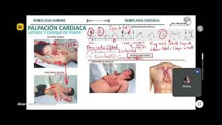 PALPACIÓN II SEMIOLOGÍA CARDIACA [upl. by Goldenberg383]