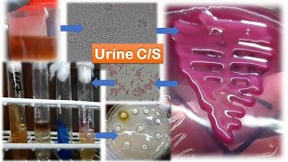 Klebsiella pneumoniae in Urine sample Colony morphology Gram stain Biochemical Tests Antibiogram [upl. by Revlys]