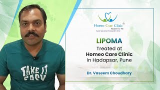 Lipoma Treatment by Homeopathic Doctor in Hadapsar Pune  Dr Vaseem Choudhary [upl. by Yroj486]