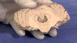 The Cerebellum Neuroanatomy Video Lab  Brain Dissections [upl. by Fitzgerald]