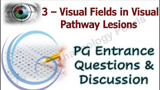 Visual Fields in Visual Pathway Lesions PG Entrance Questions amp Discussion 3 [upl. by Bloxberg]