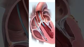 हार्ट के वाल्व को कैसे ठीक करते है  Repair Heart Valve in 3D Animation  Easy StepbyStep Guide [upl. by Arymahs]