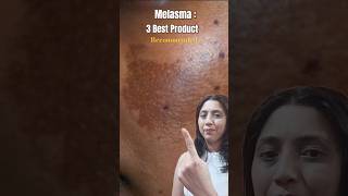 Melasma treatment  3 Best Product Recommended youtubeshorts melasmatreatment [upl. by Pearle]