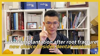 Autotransplantation after root fracture new choice besides dental implant [upl. by Hildick169]