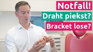 Notfall Draht von der festen Zahnspange piekst Bracket ist lose KFO1  Praxis Dr Schmidt [upl. by Adnirb719]