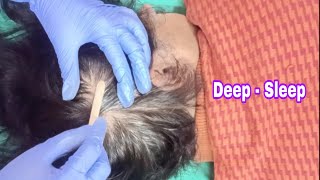 Scalp Check amp Treatment ASMR  Tingles Trichotillomania amp More [upl. by Aras995]