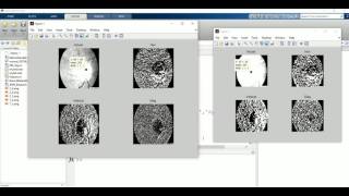 Retina Image Segmentation With Wavelet Transform From Scratch Matlab Code [upl. by Gunas519]