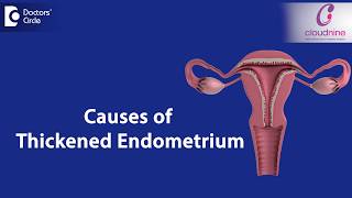 What causes Endometrial thickness  DrSmitha Sha of Cloudnine Hospitals  Doctors Circle [upl. by Cecile]