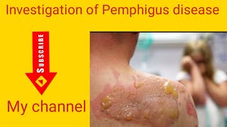 skin disease investigation of Pemphigus disease [upl. by Tareyn595]