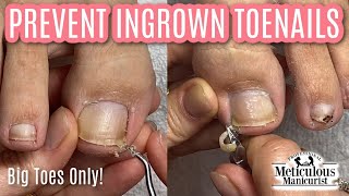 👣Big Toes Only  Mr Meticulous Deep Sidewall Cleaning to Prevent Ingrown Toenails👣 [upl. by Kee]