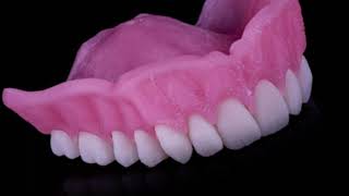 Absolutes Digital Denture Journey [upl. by Rep750]