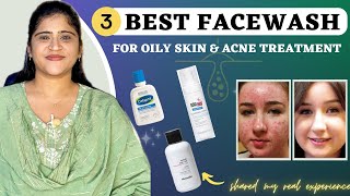 Oily amp Acne prone skin  3 Best Facewash  Dr Arwa Bohra [upl. by Jarvis]