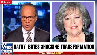 Kathy Bates Is TURNING HEADS After Weight Loss [upl. by Enrobyalc]