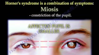 The Brachial Plexus amp Horners Syndrome  Everything You Need To Know  Dr Nabil Ebraheim [upl. by Healey]