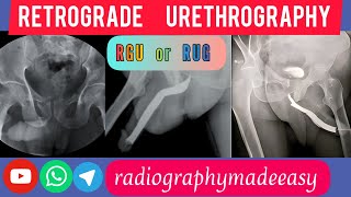 Retrograde Urethrography  RGURUG  Urinary Tract  Aaqib Bhat [upl. by Deach]