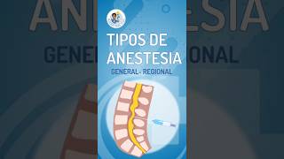 😴 TIPOS DE ANESTESIA LOCAL REGIONAL EPIDURAL Y GENERAL [upl. by Leinoto]