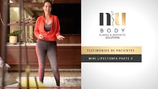 Testimonio de Minilipectomía y Liposucción NuBody  Parte 4 [upl. by Nomzed40]