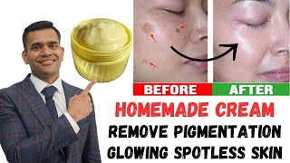 Remove Dark spots Pigmentation And Get Younger Glowing Spotless Skin  Dr Vivek Joshi [upl. by Ahcrop]