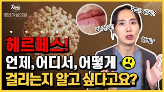 헤르페스 범인을 찾아라 피검사 항체검사 PCR검사 헤르페스 검사 결과 왜 이렇게 나오는지 궁금하다면 [upl. by Annawit]