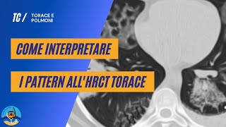 Come interpretare i pattern allHRCT torace  parte 1 [upl. by Shaylynn]