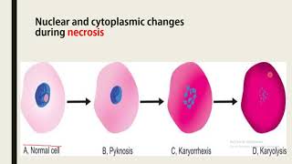 pyknosiskaryorrhexiskaryolysis يُنتَفع به [upl. by Ohara]