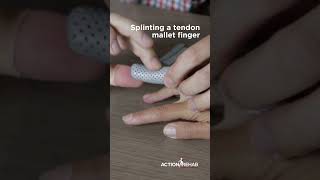 Mallet finger splint demo [upl. by Klarrisa424]