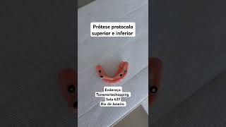 Prótese protocolo superior e inferior dentadurafixa proteseprotocolo [upl. by Naryk681]