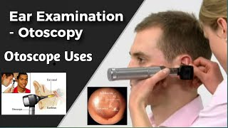 Ear Examination and Otoscopy How To Use  How To Purchase Otoscope Device Otoscope ke fyde [upl. by Aneet558]