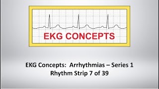 EKG Concepts Arrhythmias Course  Strip 7 of 39 [upl. by Aseel]