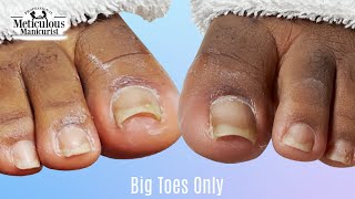 👣Big Toes Only  Pedicure TOENAIL CLEANING at Home👣 [upl. by Epilihp]