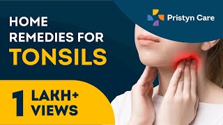 टॉन्सिलाइटिस का घरेलू उपचार  Home remedies for Tonsillitis [upl. by Jardena]