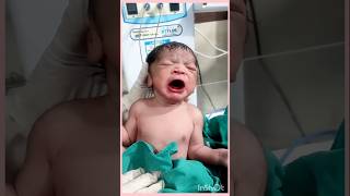 Neonatal baby just after birth admit in nicu newbornbaby doctor hospital 🏥subscribemychannel 🙏🙏🙏 [upl. by Pratte]